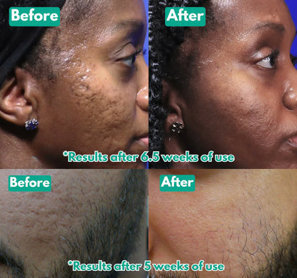 Microcrystal™ Serum PM Duo